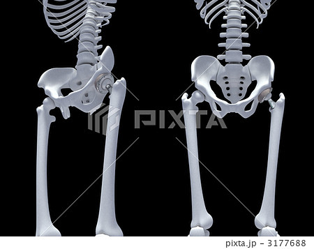 人工関節のイラスト素材