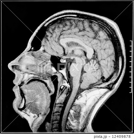 頭部ct 断面の写真素材