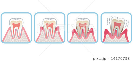 歯のイラスト素材集 ピクスタ