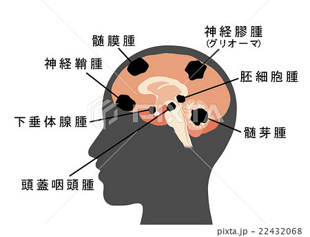 脳の断面図のイラスト素材