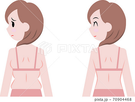 Women wearing girdles after childbirth (beauty, - Stock Photo [83261843]  - PIXTA