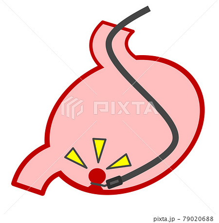 消化器のイラスト素材