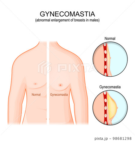 9,395+ Cosmetic surgery/Plastic surgery Illustrations: Royalty